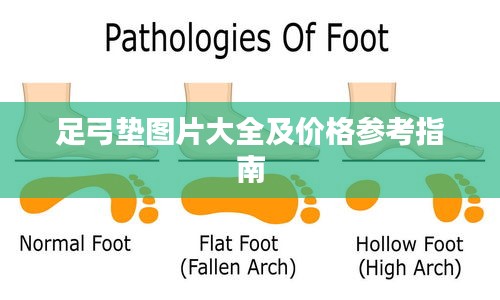 足弓垫图片大全及价格参考指南